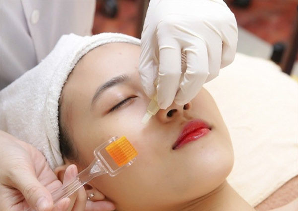 Điều trị sẹo lõm bằng kỹ thuật phi kim vi điểm Microneeding kết hợp tách đáy sẹo