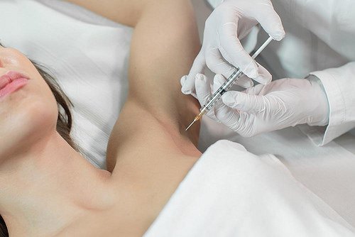 Điều trị tăng tiết mồ hôi nách