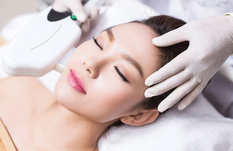 Triệt lông vùng mặt (bao gồm cả mép)