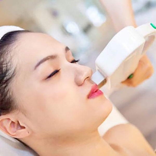 Triệt lông vùng mép
